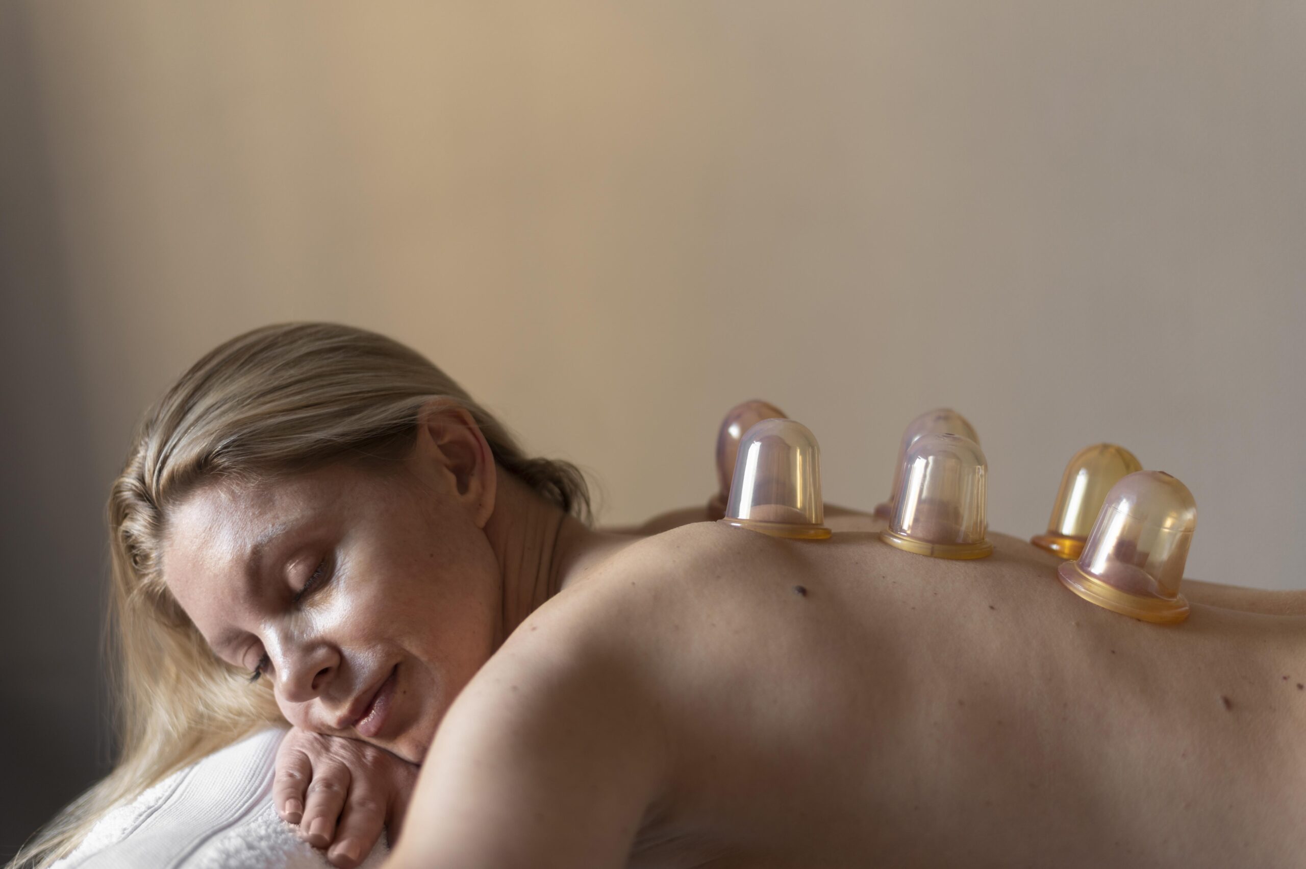 Dieses Bild zeigt Schröpfen am Rücken zum Entgiften - massage-mariana.ch